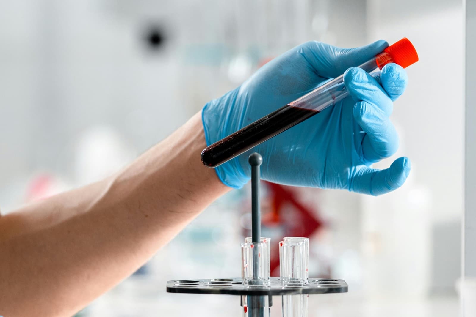 A vial of blood for a hormone panel — the lab work a real TRT clinic runs before prescribing anything