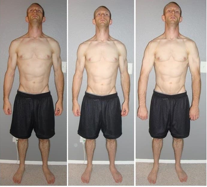 Patient J.G. of Anaheim — earlier recovery progression after muscle-wasting atrophy