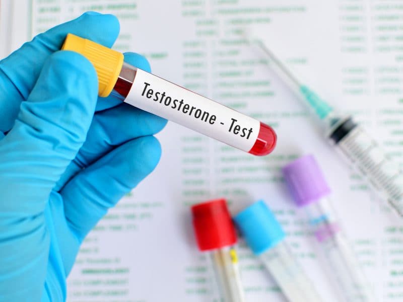 Gloved hand holding a labeled testosterone blood test tube — lab-led TRT process at Castellano Health Institute